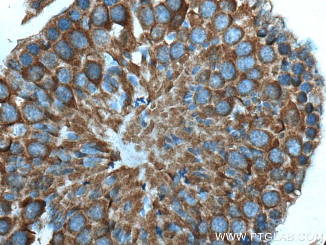 TBC1D5 Antibody in Immunohistochemistry (Paraffin) (IHC (P))