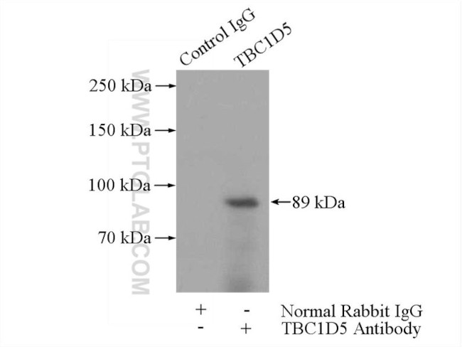 TBC1D5 Antibody in Immunoprecipitation (IP)