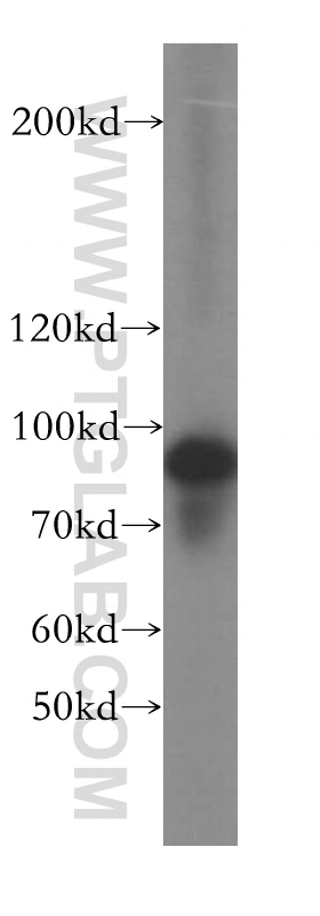 TBC1D5 Antibody in Western Blot (WB)