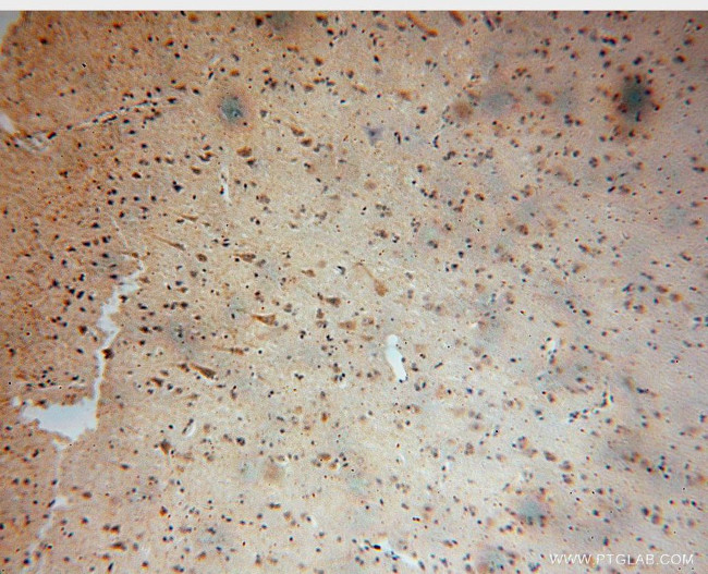 AUH Antibody in Immunohistochemistry (Paraffin) (IHC (P))