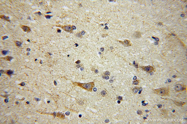 AUH Antibody in Immunohistochemistry (Paraffin) (IHC (P))