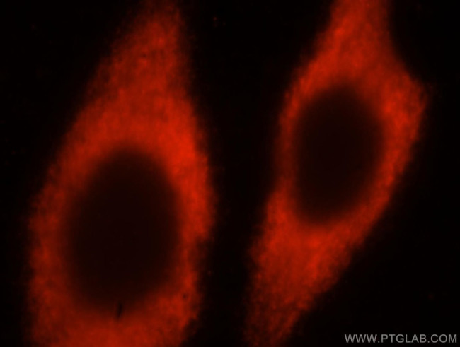 RPL24 Antibody in Immunocytochemistry (ICC/IF)