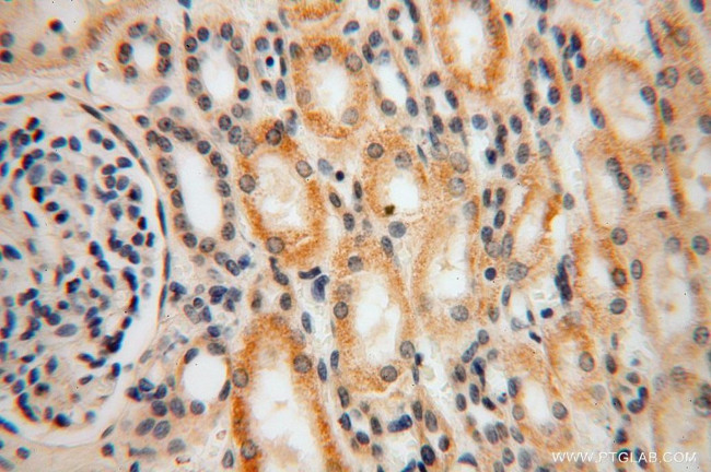 RPL24 Antibody in Immunohistochemistry (Paraffin) (IHC (P))