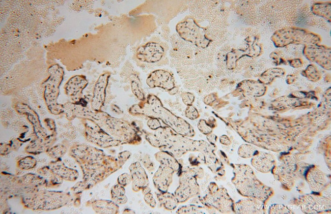 RPL24 Antibody in Immunohistochemistry (Paraffin) (IHC (P))