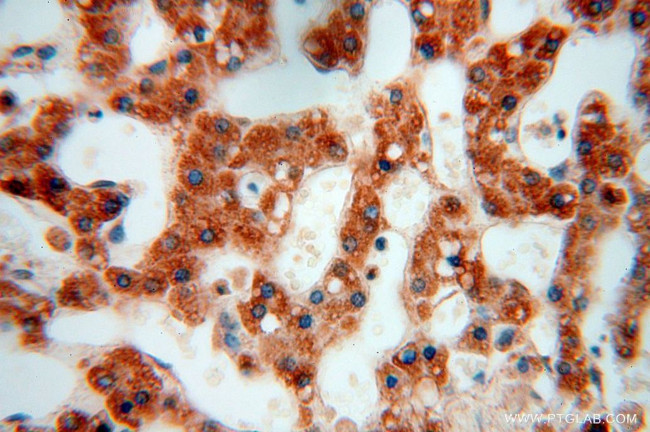 RPL24 Antibody in Immunohistochemistry (Paraffin) (IHC (P))