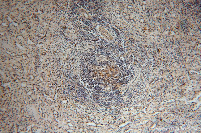 RPL24 Antibody in Immunohistochemistry (Paraffin) (IHC (P))