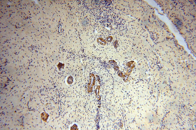 RPL24 Antibody in Immunohistochemistry (Paraffin) (IHC (P))