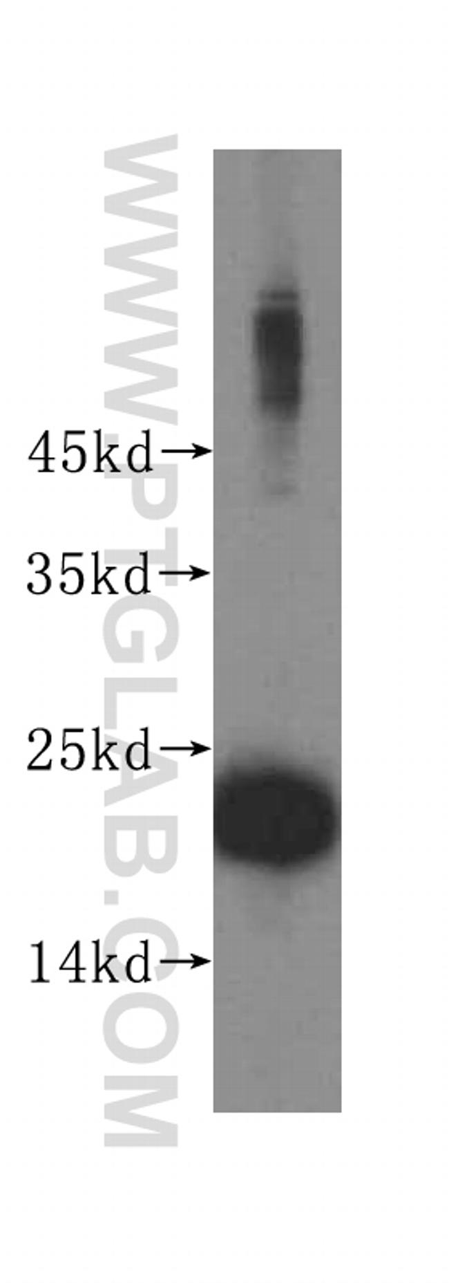 RPL24 Antibody in Western Blot (WB)