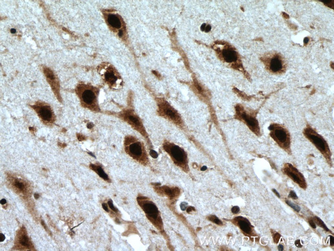 LUC7L Antibody in Immunohistochemistry (Paraffin) (IHC (P))