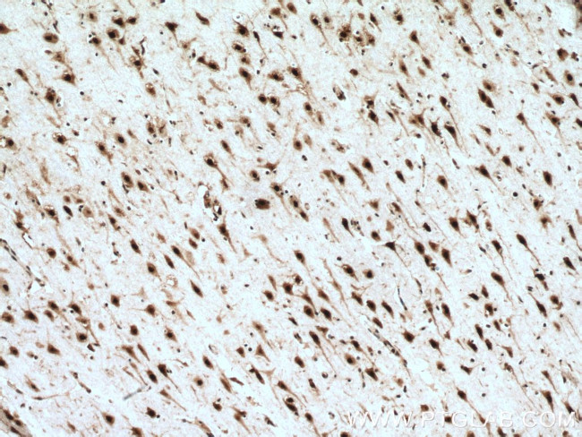 LUC7L Antibody in Immunohistochemistry (Paraffin) (IHC (P))