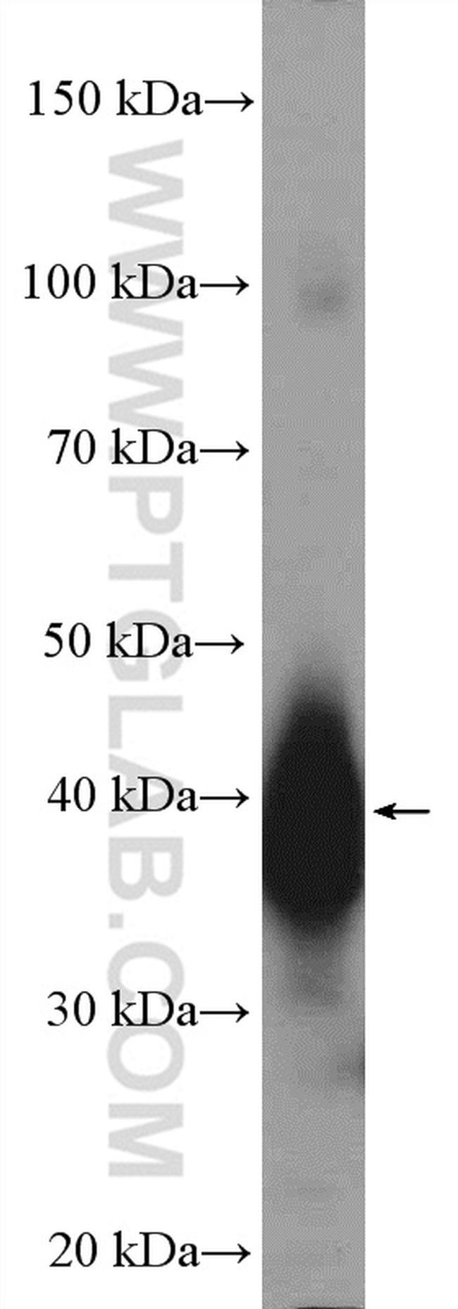 LUC7L Antibody in Western Blot (WB)