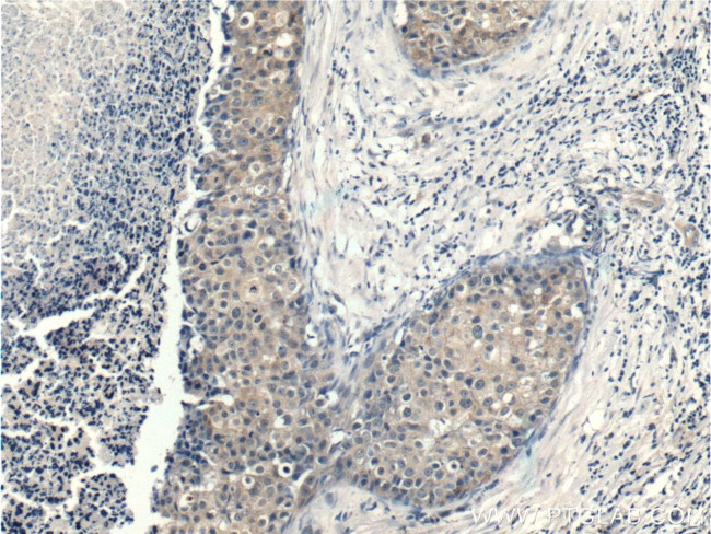 PDPK1 Antibody in Immunohistochemistry (Paraffin) (IHC (P))