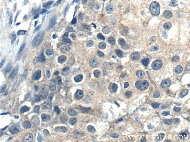 PDPK1 Antibody in Immunohistochemistry (Paraffin) (IHC (P))