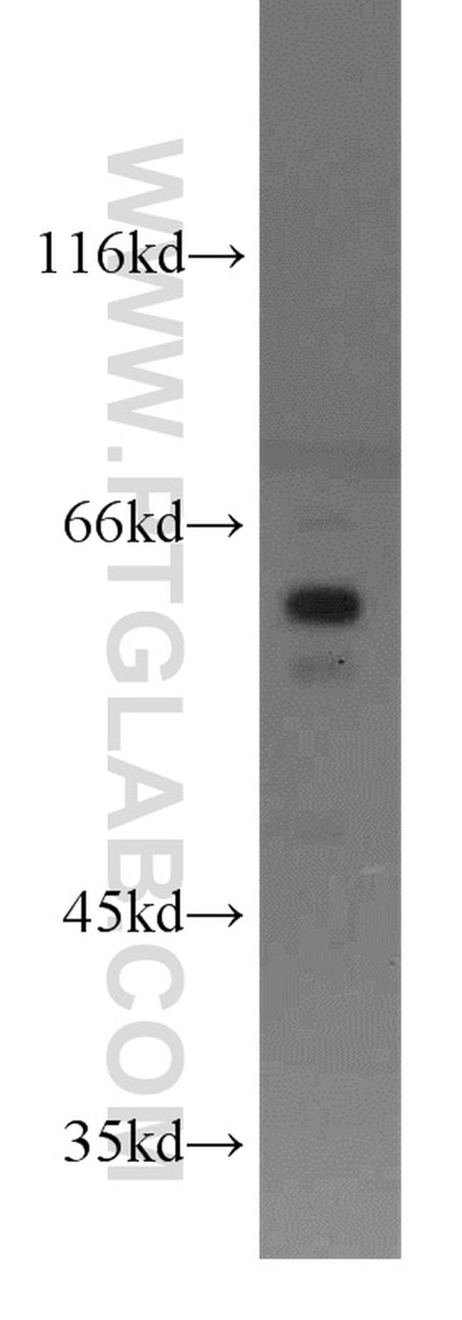 PDPK1 Antibody in Western Blot (WB)