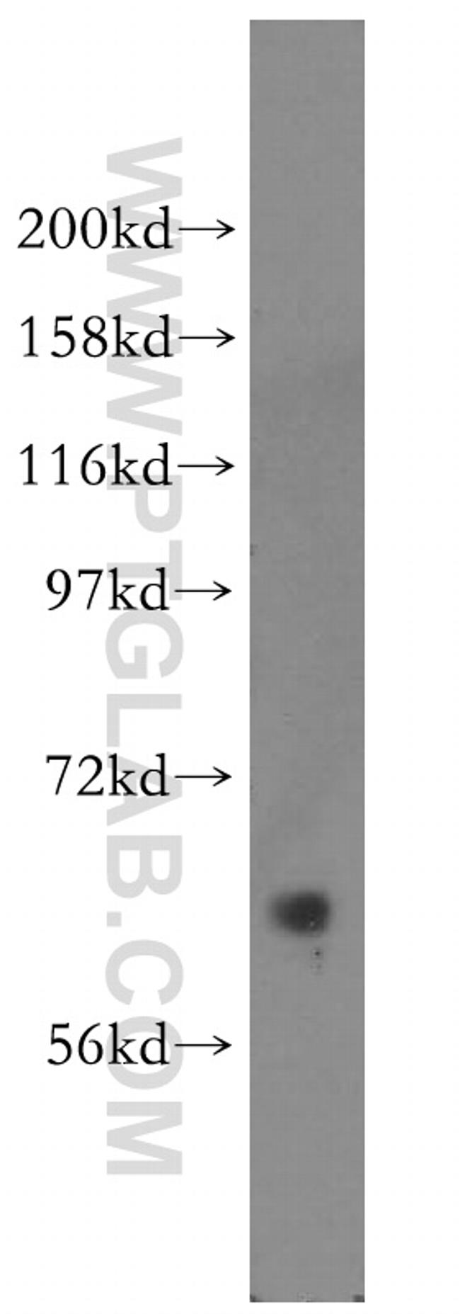 PDPK1 Antibody in Western Blot (WB)