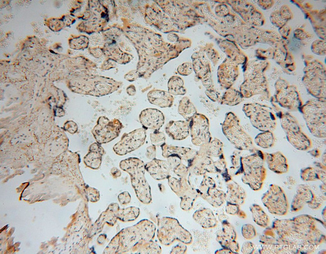 TUBGCP4 Antibody in Immunohistochemistry (Paraffin) (IHC (P))