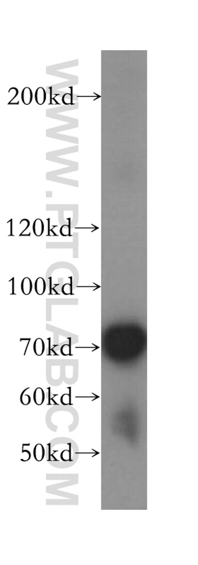 TUBGCP4 Antibody in Western Blot (WB)