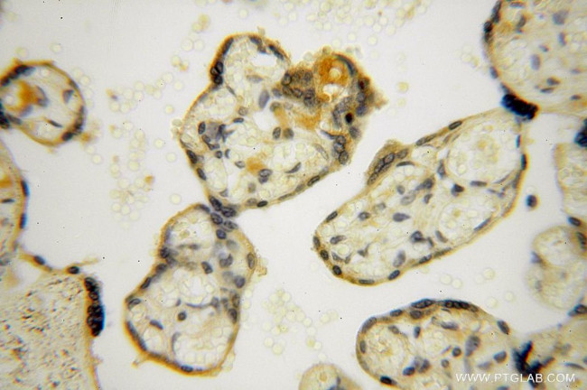 TUBGCP4 Antibody in Immunohistochemistry (Paraffin) (IHC (P))