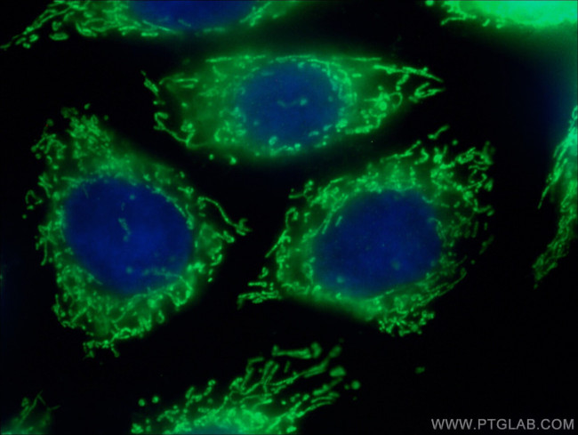 OAT Antibody in Immunocytochemistry (ICC/IF)