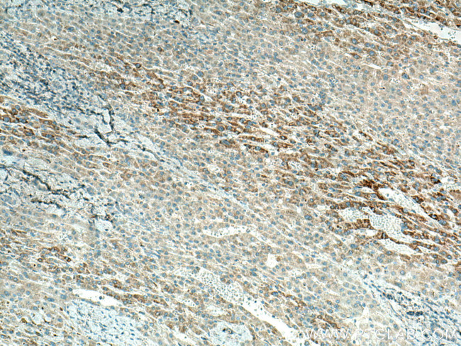 OAT Antibody in Immunohistochemistry (Paraffin) (IHC (P))