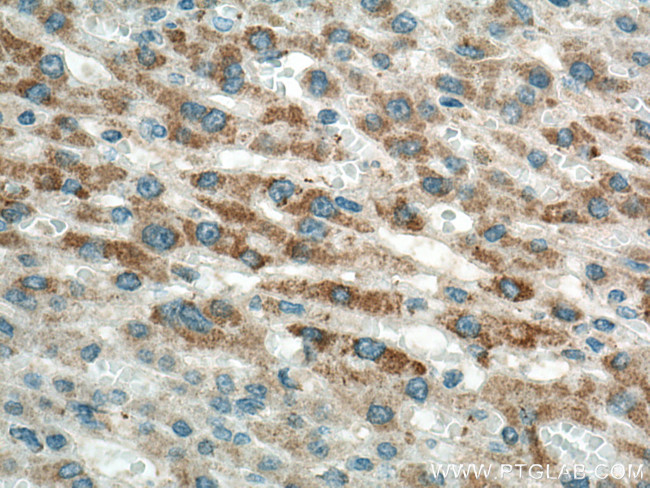 OAT Antibody in Immunohistochemistry (Paraffin) (IHC (P))