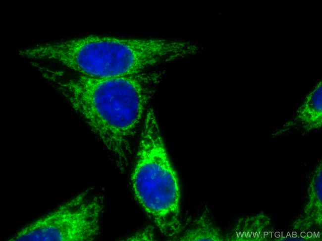 MFF Antibody in Immunocytochemistry (ICC/IF)