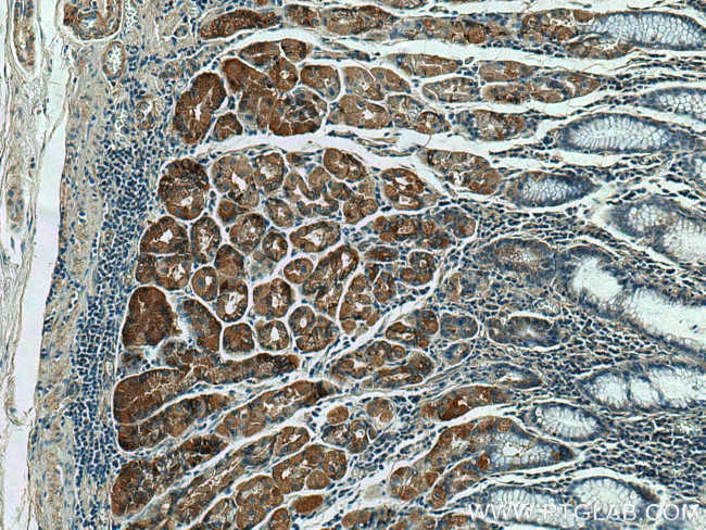 MFF Antibody in Immunohistochemistry (Paraffin) (IHC (P))