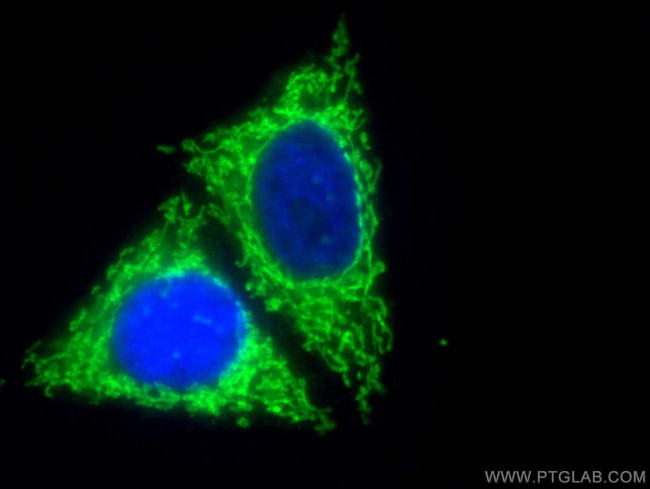 MFF Antibody in Immunocytochemistry (ICC/IF)