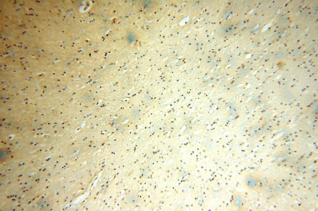 MFF Antibody in Immunohistochemistry (Paraffin) (IHC (P))