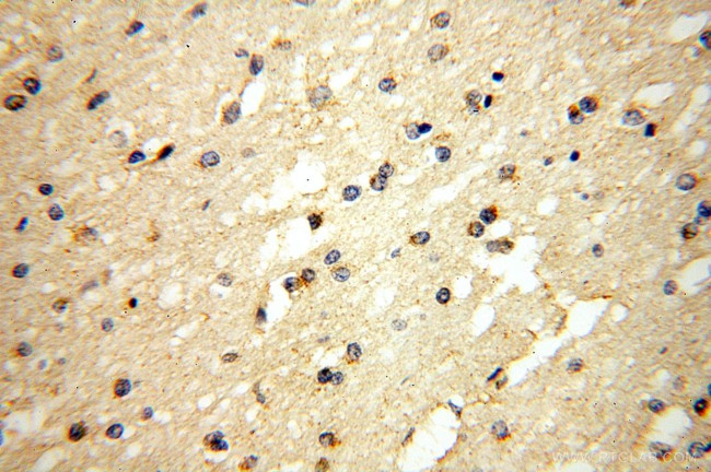 MFF Antibody in Immunohistochemistry (Paraffin) (IHC (P))