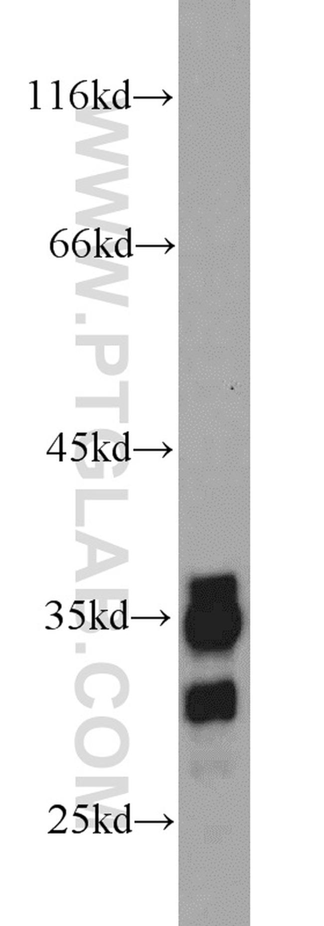 MFF Antibody in Western Blot (WB)