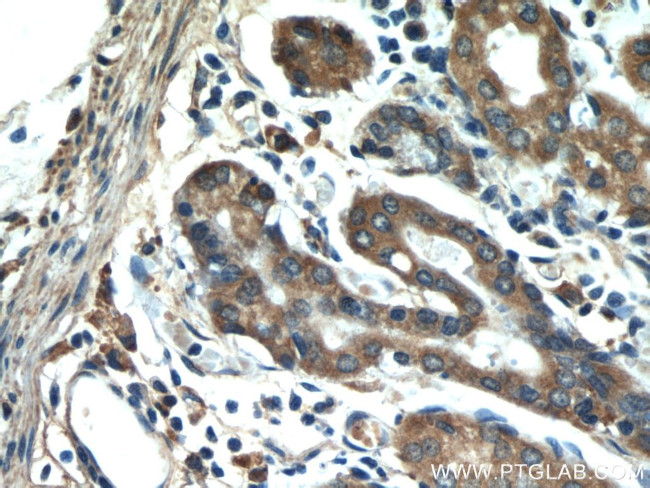 MFF Antibody in Immunohistochemistry (Paraffin) (IHC (P))