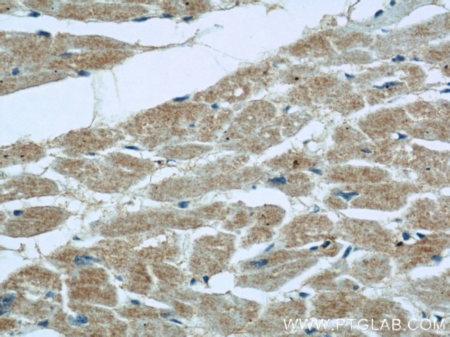 MFF Antibody in Immunohistochemistry (Paraffin) (IHC (P))