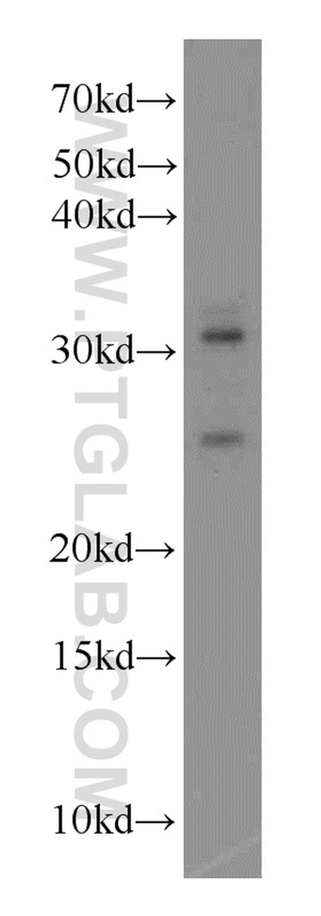 MFF Antibody in Western Blot (WB)