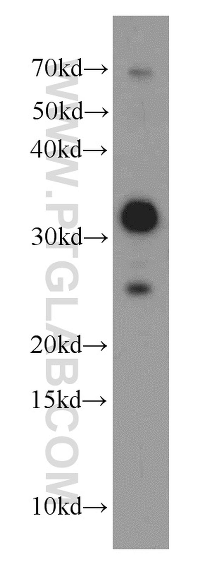 MFF Antibody in Western Blot (WB)