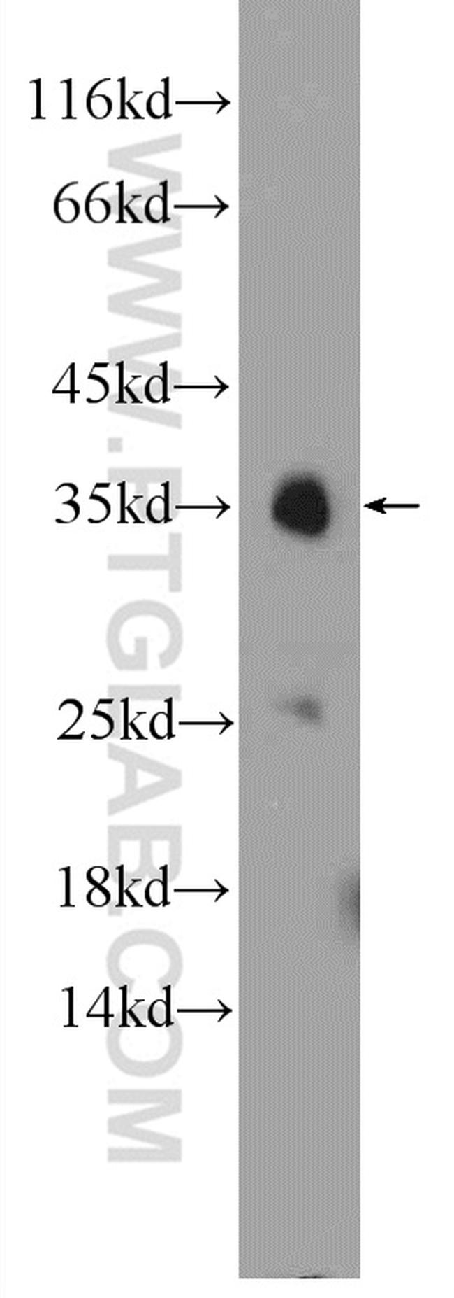 MFF Antibody in Western Blot (WB)