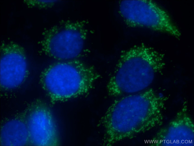 LARS2 Antibody in Immunocytochemistry (ICC/IF)