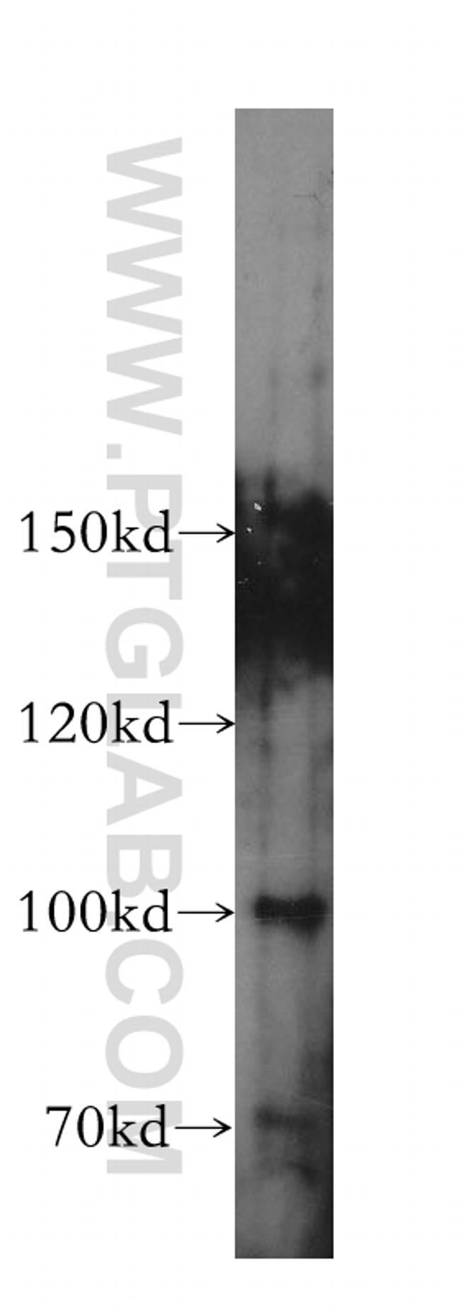 LARS2 Antibody in Western Blot (WB)