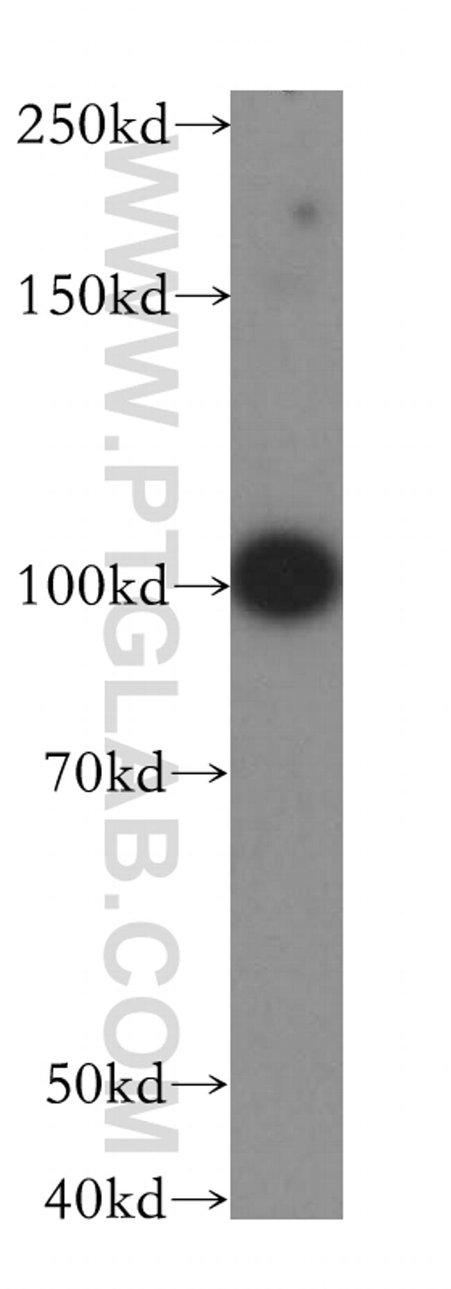 LARS2 Antibody in Western Blot (WB)