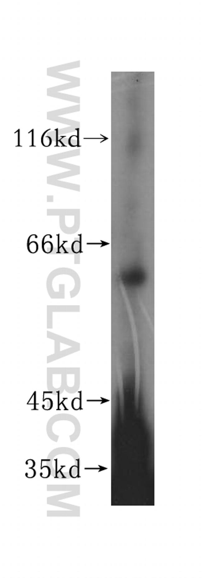 DCTN4 Antibody in Western Blot (WB)