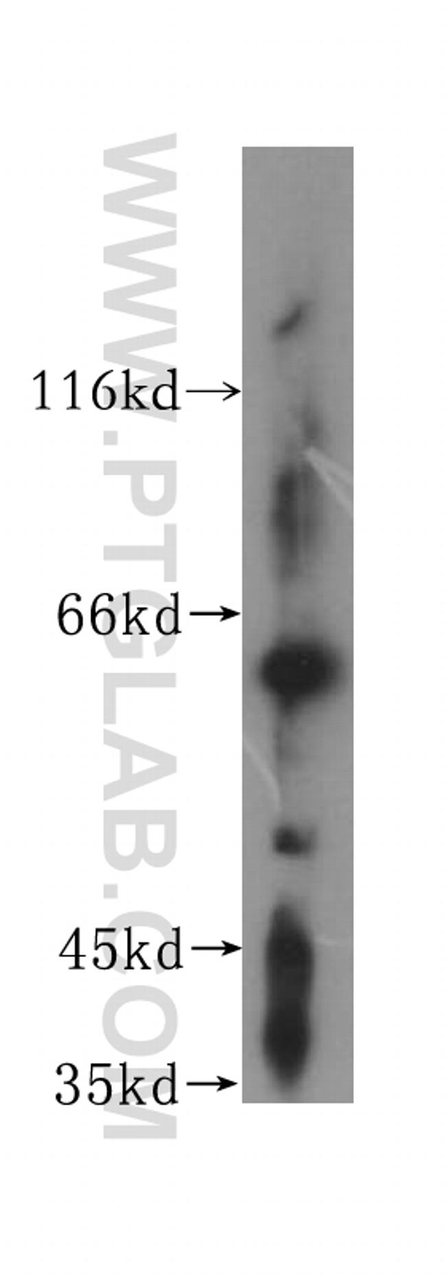 DCTN4 Antibody in Western Blot (WB)