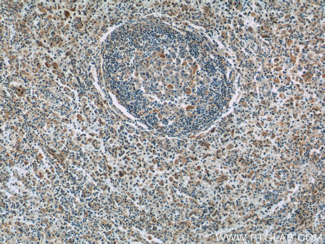 GNPDA2 Antibody in Immunohistochemistry (Paraffin) (IHC (P))