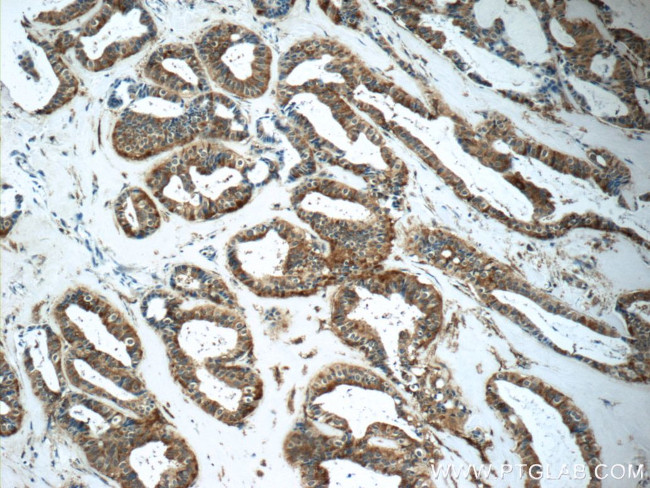 GNPDA2 Antibody in Immunohistochemistry (Paraffin) (IHC (P))