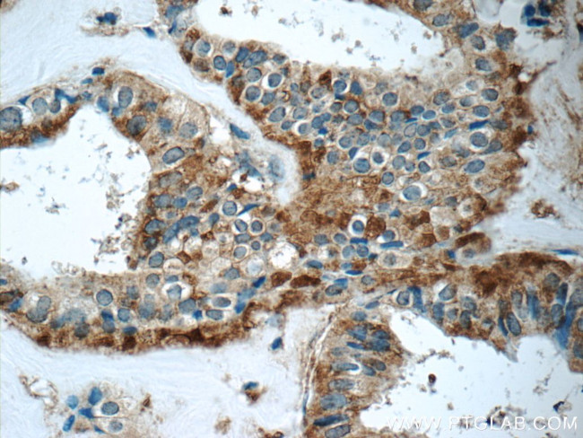 GNPDA2 Antibody in Immunohistochemistry (Paraffin) (IHC (P))