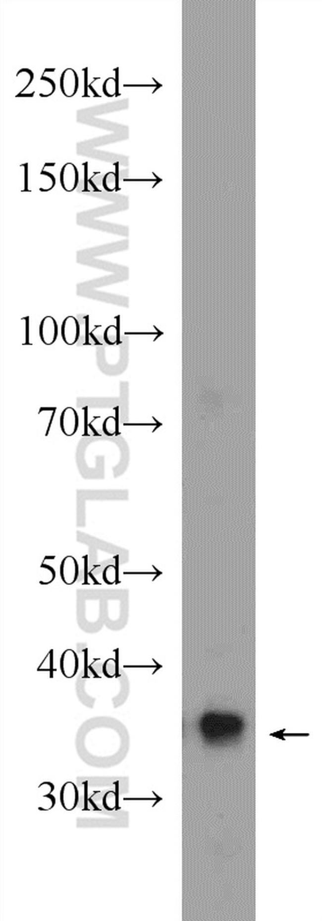 GNPDA2 Antibody in Western Blot (WB)