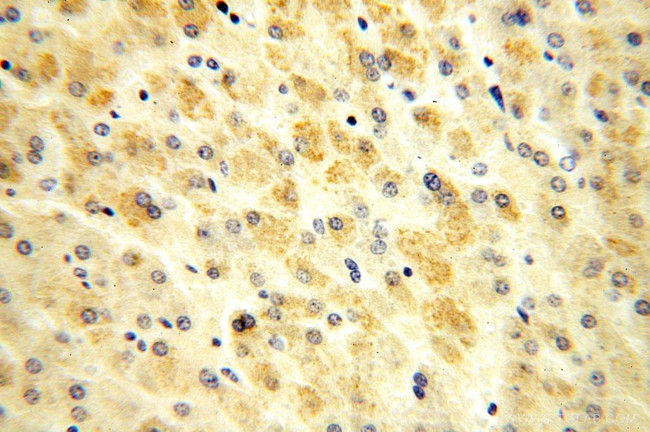 OGDHL Antibody in Immunohistochemistry (Paraffin) (IHC (P))