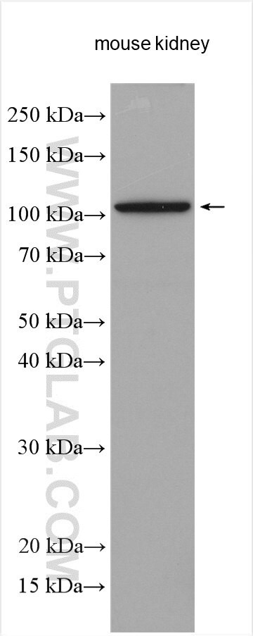 OGDHL Antibody in Western Blot (WB)