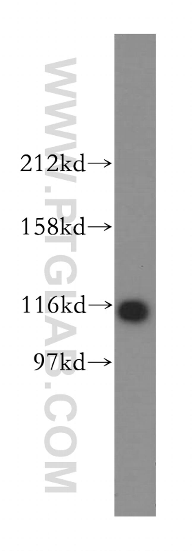 OGDHL Antibody in Western Blot (WB)