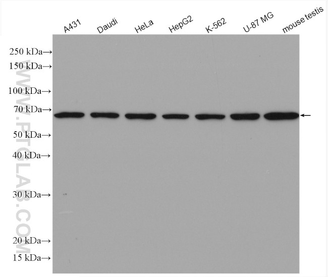 ATP6V1A Antibody in Western Blot (WB)