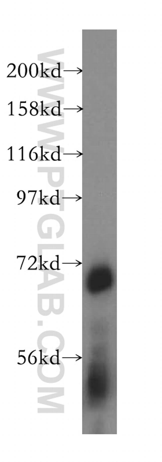 ATP6V1A Antibody in Western Blot (WB)